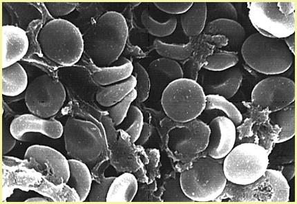 APPARATO CARDIOCIRCOLATORIO IL SANGUE Il sangue è formato da diversi elementi cellulari in sospensione in un liquido, detto plasma.