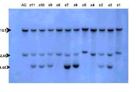 del filtro ottenuto dopo trasferimento su filtro (Southern blot) e