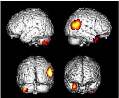 Dalla neuro-anatomia alla funzione Connessionismo cellulare (K. Wernicke and R. Cajal, fine 1800) I neuroni sono connessi tra loro in gruppi funzionali. Le connessioni sono in numero definito.