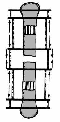 Secondo le varie forme, si applicano i seguenti trattamenti: Nel tipo B1 si distinguono tre varianti: B1.A: in perdite di sostanza sino a 5 cm.