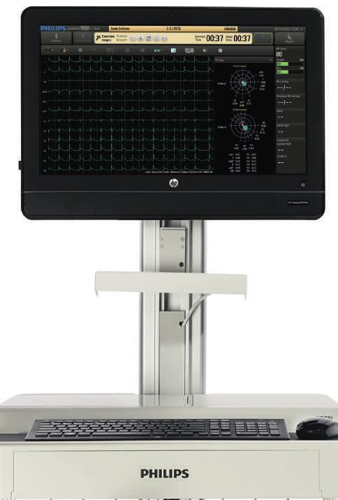 Metodi avanzati di analisi Philips ST80i è dotato di strumenti che semplificano l'analisi dei dati delle prove da sforzo da parte dei medici.