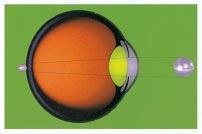attraverso la quale la luce entra nell occhio per andare a focalizzarsi sulla retina che come una pellicola crea l immagine.