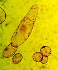 Colture cellulari Principali parametri chimico-fisici dell ambiente colturale: Luce (composizione spettrale, intensità e fotoperiodo) Temperatura Composizione chimica del mezzo