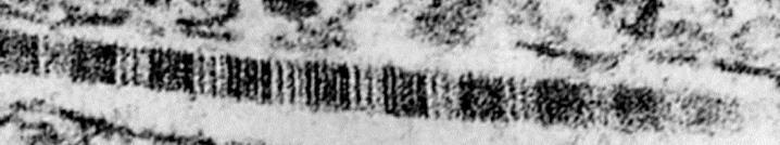 Periodicità della fibrilla di collagene Zona vuota (36 nm) Qui le fibrille sono colorate positivamente con acido fosfotungstico all 1%, ph 3,4) e poi acetato di uranile (1%, ph 4,2).