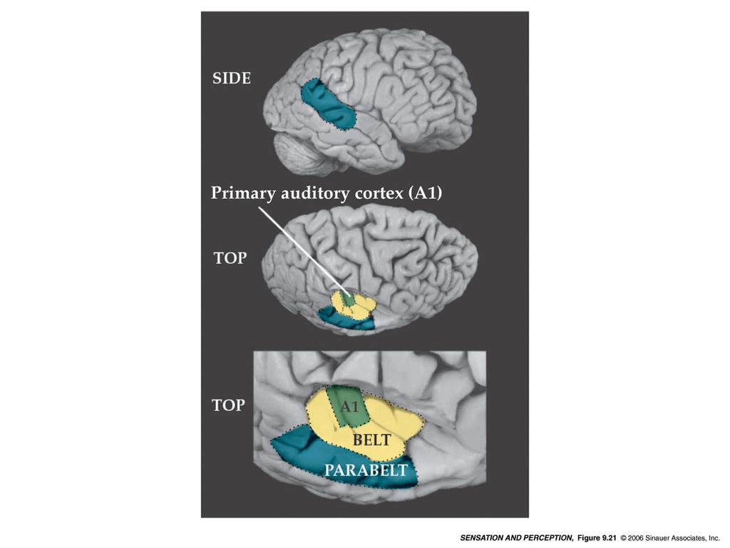 Il sistema uditivo //Dal nervo acustico al cervello Temporal lobes Primary auditory cortex (A1): The first area within the temporal lobes of the brain responsible for processing acoustic organization