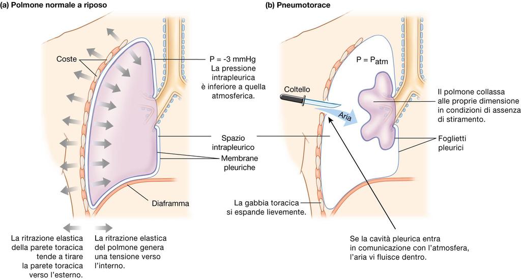 Pleure e pressione intrapleurica (parietale e viscerale) espansione X Le pleure sono membrane che avvolgono ciascun polmone.