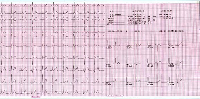 8 Informazioni di Aiuto ECG Premere il tasto HELP per entrare nel menu di Aiuto.