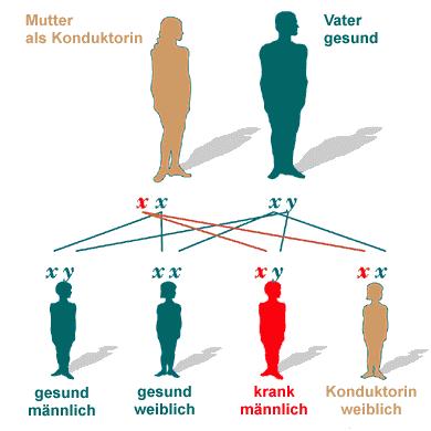 DEFICIT DI GLUCOSIO-6-FOSFATO-DEIDROGENASI Gene localizzato sul cromosoma