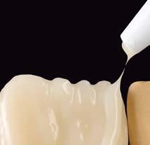 bassa viscosità per riabilitazioni dentali fisse e mobili.