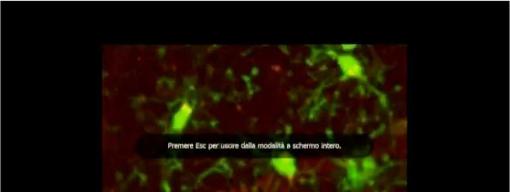 Dopo un insulto (evento in giallo) la microglia (in verde) parte in