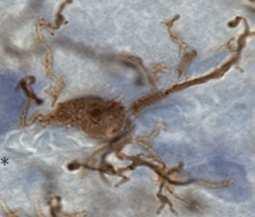 Microglia Ameboide Le cellule microgliali sono