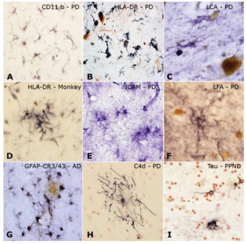 REVIEW How neuroinflammation contributes to neurodegeneration Richar d M.