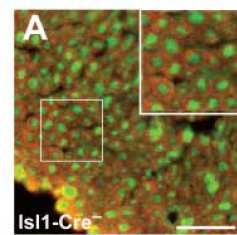 L espressione del gen msod1 nella microglia ha prodotto un