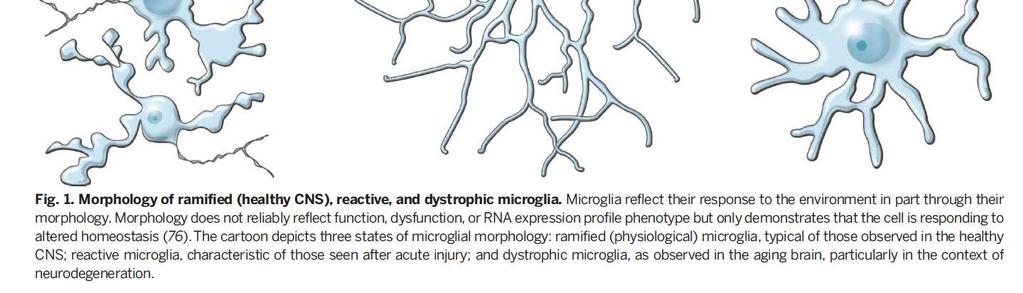 La neuroinfiammazione in malattie come AD, PD e ALS è caratterizzata da una morfologia reattiva delle cellule gliali,