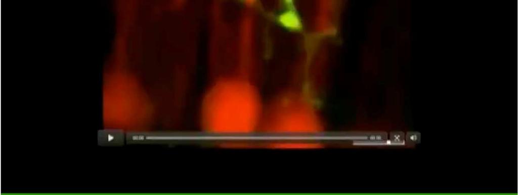 ore Video: La Microglia ( in verde) sorveglia costantemente il cervello estendendo e accorciando