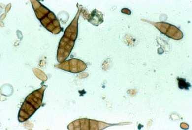 Le spore costituiscono l'organo fondamentale della riproduzione e della diffusione delle specie fungine e sono prodotte dai miceti durante il loro ciclo di vita.