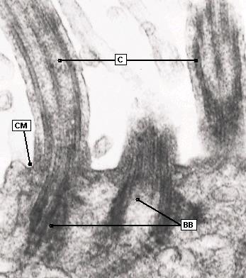 Estroflessioni  microtubuli.