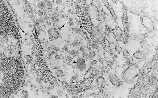 Apparato del Golgi Fu definito apparato reticolare