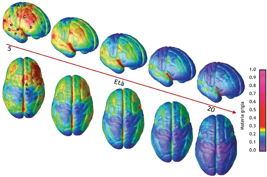 Evoluzione dai 5 ai 20 anni d età della normale maturazione cerebrale.