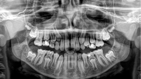 PAN / CEPH Il futuro dell ortodonzia è direttamente in sede, nello Studio odontoiatrico, e il CS 8100SC 3D è