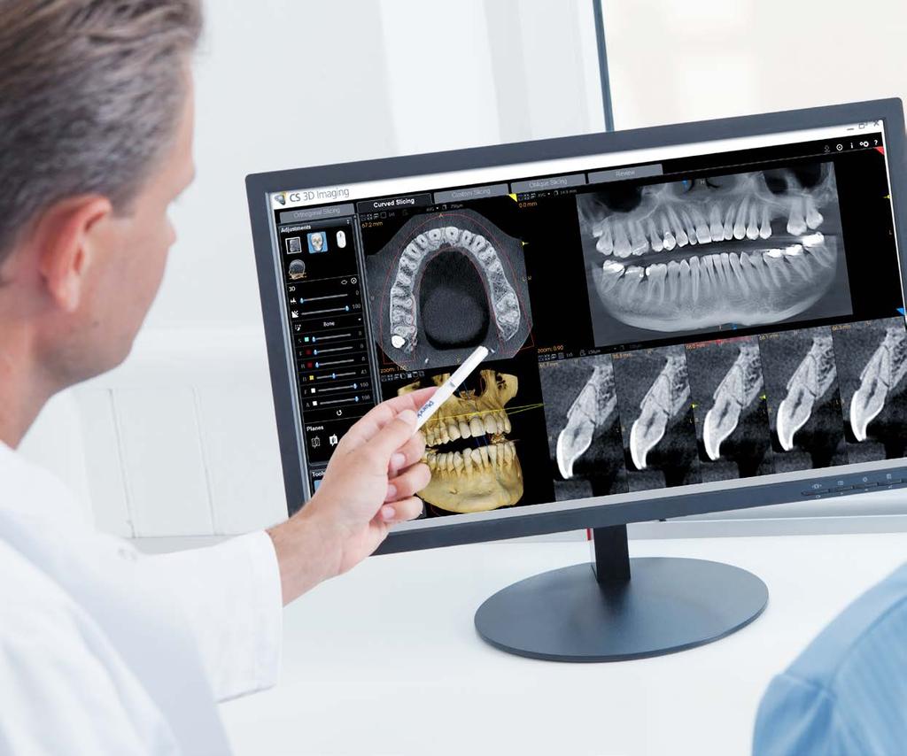 ENTRATE NELLA ODONTOIATRIA DIGITALE Il CS 8100 3D, l apparecchiatura 3D di maggior successo di Carestream Dental, ora è disponibile con un modulo opzionale per imaging cefalometrico.