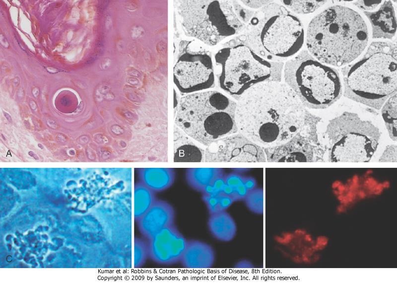 Morphologic