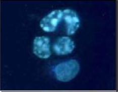 Citofluorimetria: - parametri fisici: dimensione cellulare (ridotta nelle cellule apoptotiche) - Fluorescenza: PI (minore fluorescenza in caso di DNA frammentato) Coloranti fluorescenti: PI,