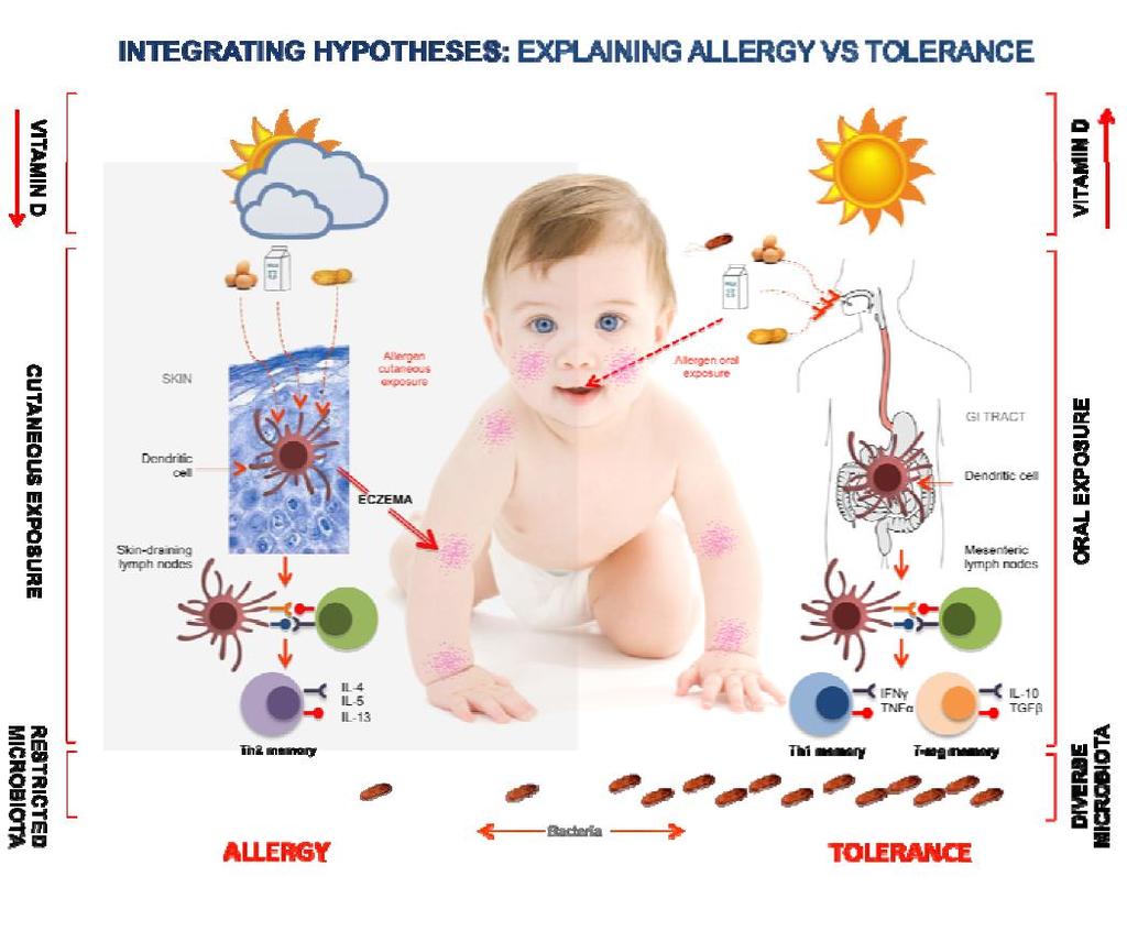 Allergia e tolleranza Du Toit G et al.