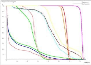 Case 1: significative increase of Dmax to PTV N /PTV Boost QC pre-treatment Tolleranze 3%-3mm