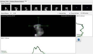 5 Campo 7 91.9 82.7 51.8 Media 94.4 85.7 54.9 Local Gamma Index %GP=93.1; 97.