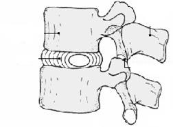 la colonna vertebrale processo spinoso processo trasverso Rachide cervicale (lordosi) Vertebre da C1 a C7 forame vertebrale corpo vertebrale Rachide dorsale (cifosi) Vertebre da T1 a T12 esempio di