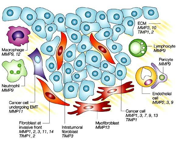 Espressione di MMPs e di TIMPs nei carcinomi mammari Oltre alle cellule tumorali, i tumori mammari contengono cellule stromali, che includono fibroblasti, miofibroblasti, cellule endoteliali,