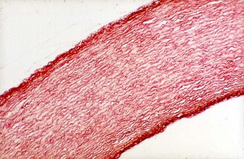 prevalgono le fibre elastiche si ritrova nella parete delle