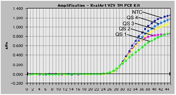 26: Rilevazione del Controllo interno (IC) mediante la rilevazione di un segnale di fluorescenza VIC (ABI PRISM 7700 SDS)