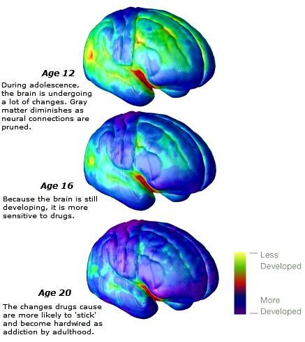 12 Anni Durante l adolescenza il cervello va incontro a molti cambiamenti. La Sostanza Grigia si assottiglia poiché le connessioni neurali vengono sfoltite.