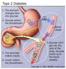 Diabete