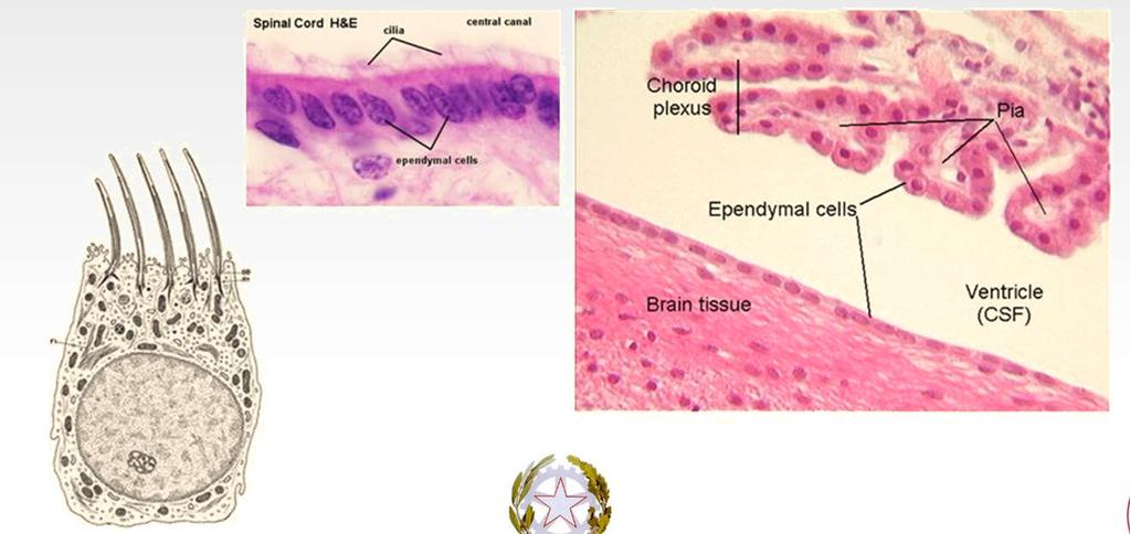 Cellule ependimali hanno forma cubica/cilindrica compongono l ependima, il sottile epitelio che riveste le cavità interne del sistema cerebro-spinale (ventricoli cerebrali e canale centrale del