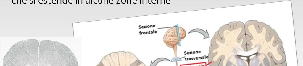 Nel midollo spinale la sostanza bianca è esterna e avvolge un nucleo interno di