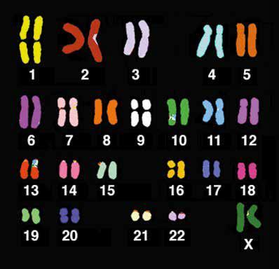 Il cariotipo Il cariotipo di un individuo rappresenta l insieme delle caratteristiche dei cromosomi di