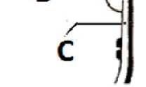 Con quale lettera, tra quelle 1 proposte nelle alternative di risposta, è indicato il baglio? a) la lettera A. b) con la lettera B. c) con la lettera C.