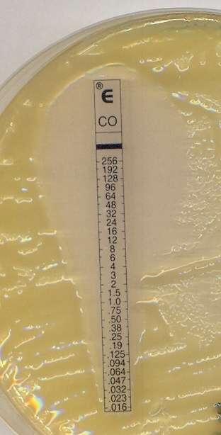 Colistin susceptibility breakpoint 2 mg/l Rifampin peak