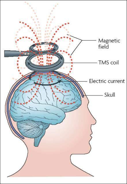 LA STIMOLAZIONE MAGNETICA La TMS (Transcranial Magnetic Stimulation) consiste sostanzialmente nella generazione di un campo magnetico che induce u attività elettrica nel cervello.