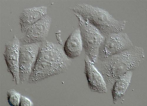 Microscopi ottici speciali Microscopio interferenziale di Nomarski (o contrasto