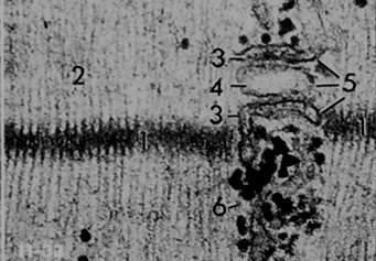 Fibra muscolare striata scheletrica la triade Microfilamenti di actina Linea Z