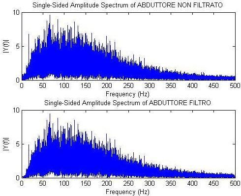 Dal punto di vista qualitativo la forma dello spettro EMG puro è completamente diversa da quella del rumore di fondo, dell'interferenza di rete e degli artefatti da movimento dei fili o della persona.