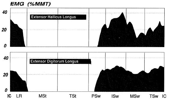 3. Analisi biomeccanica dei tendini e dei muscoli della gamba normalizzando le misure sul MVIC (massima contrazione isometrica volontaria) e risulteranno quindi più contenuti rispetto ad essa.