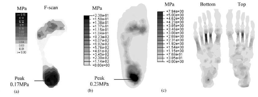 4. Modelli numerici per le componenti tendinee e muscolari del piede 4.