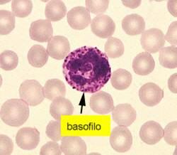 multiplo, anemia