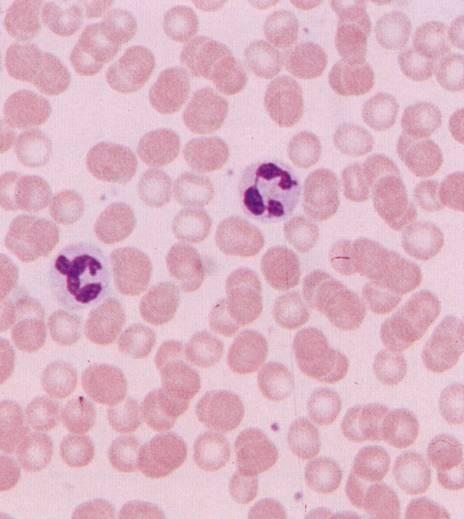 granulociti neutrofili o polimorfonucleati (65%) Sono cellule molto mobili dotate di attività fagocitaria Intervengono nelle fasi iniziali della risposta infiammatoria Sono attratti (chemiotassi) da
