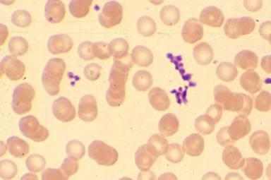 monociti (2-8%) Sono i precursori ematici dei macrofagi. MORFOLOGIA Sono cellule piuttosto grandi con Ø di 20 mm.